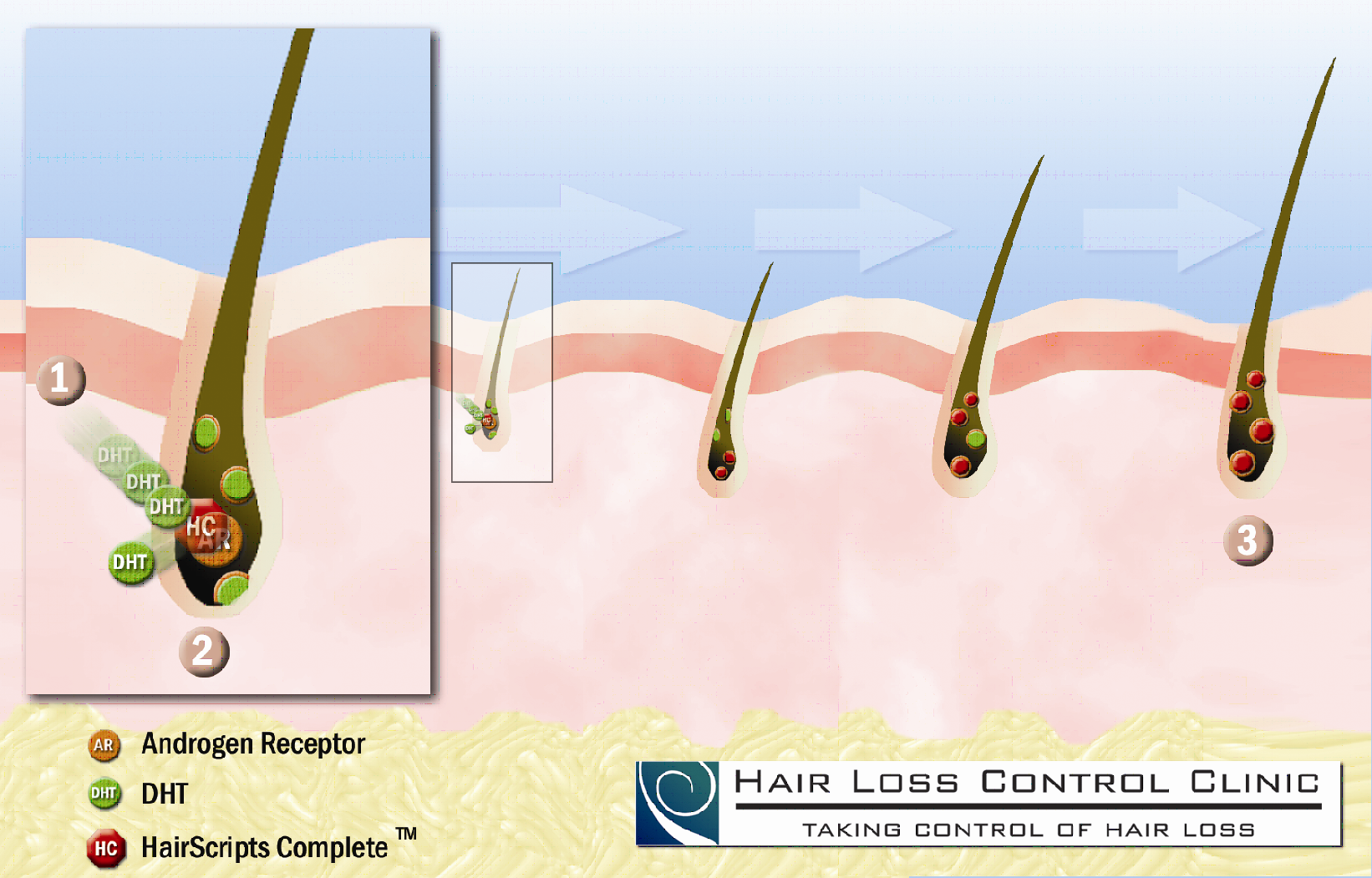 AA – Complete Information – Restorative Therapeutic Hair Loss Control & HAIR  Replacements Services