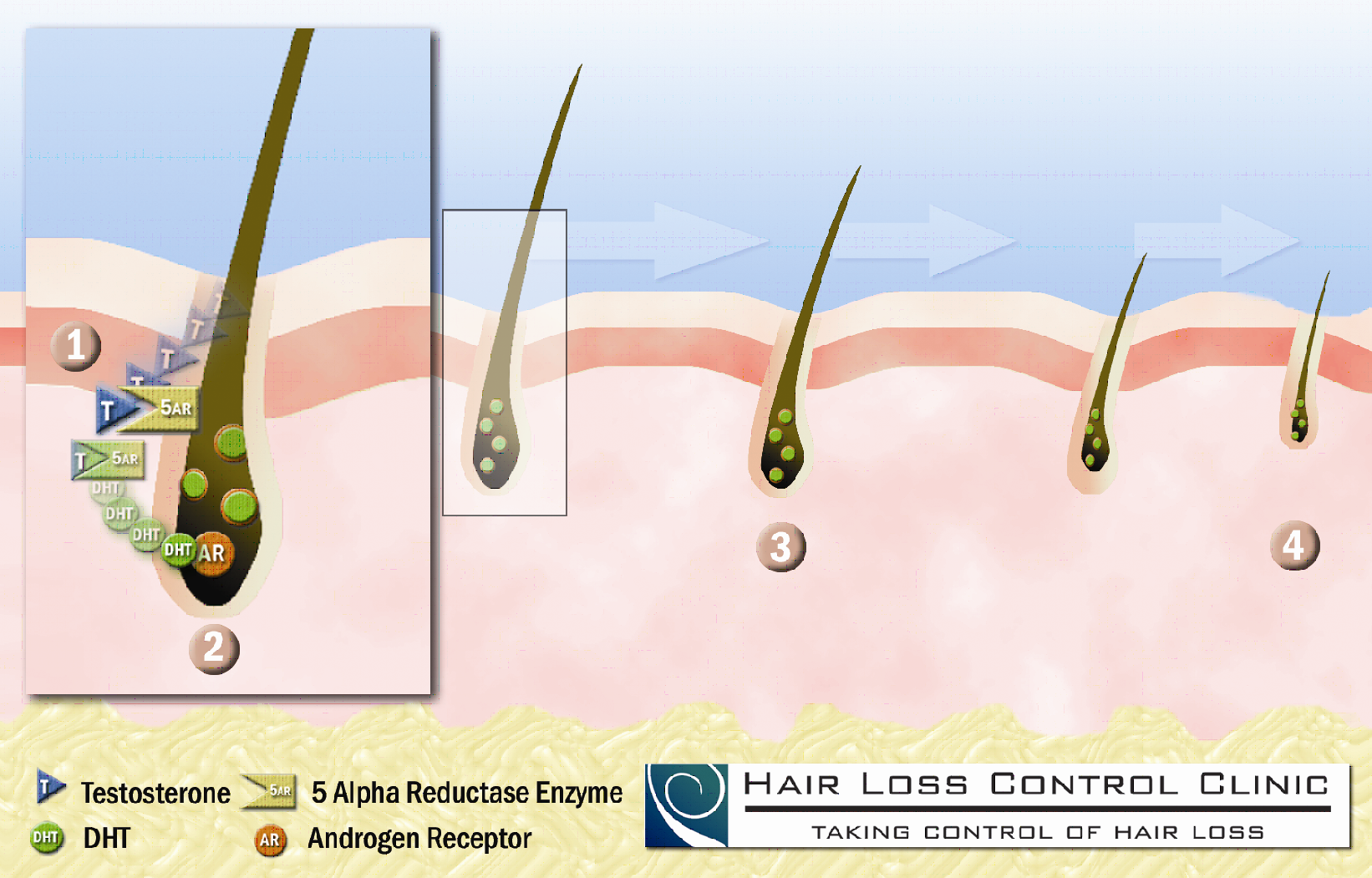 AA – Complete Information – Restorative Therapeutic Hair Loss Control & HAIR  Replacements Services
